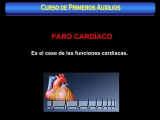 Es el cese de las funciones cardíacas. PARO CARDÍACO   Curso de Primeros Auxilios 