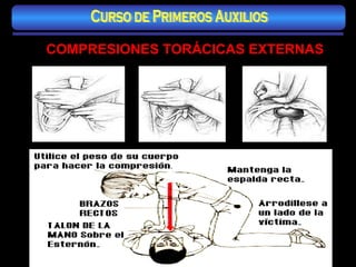 COMPRESIONES TORÁCICAS EXTERNAS Curso de Primeros Auxilios 
