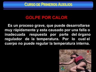 GOLPE POR CALOR Es un proceso grave, que puede desarrollarse muy rápidamente y esta causado por una falla o inadecuada  respuesta  por  parte  del órgano regulador  de  la  temperatura.  Por  lo  cual el cuerpo no puede regular la temperatura interna. Curso de Primeros Auxilios 