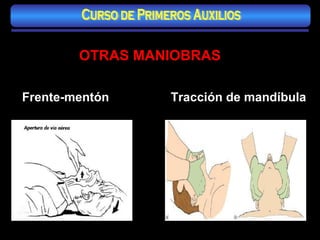 OTRAS MANIOBRAS Frente-mentón Tracción de mandíbula Curso de Primeros Auxilios 