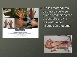 En las mordeduras
de cara o cuello se
puede producir asfixia
al obstruirse la vía
respiratoria por
inflamación o edema
 