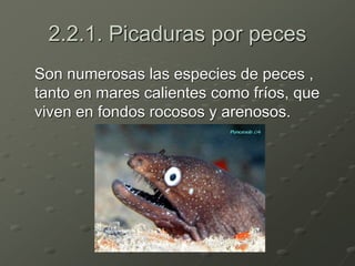 2.2.1. Picaduras por peces
Son numerosas las especies de peces ,
tanto en mares calientes como fríos, que
viven en fondos rocosos y arenosos.
 