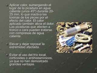 Aplicar calor, sumergiendo el
lugar de la picadura en agua
caliente (unos 45º) durante 20-
25 min, lo que inactiva las
toxinas de los peces por el
efecto del calor. El calor
aplicado también alivia el dolor.
Las picaduras que afecten a
tronco o cara pueden tratarse
con compresas de agua
caliente.
Elevar y dejar reposar la
extremidad afectada.
Evitar el uso del frío local,
corticoides o antihistamínicos,
ya que no han demostrado
grandes ventajas.
 