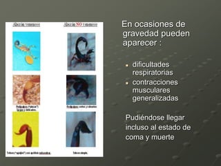 En ocasiones de
gravedad pueden
aparecer :
 dificultades
respiratorias
 contracciones
musculares
generalizadas
Pudiéndose llegar
incluso al estado de
coma y muerte
 