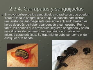 2.3.4. Garrapatas y sanguijuelas
El mayor peligro de las sanguijuelas no radica en que puedan
'chupar' toda la sangre, sino en que al hacerlo administran
una sustancia anticoagulante que sigue actuando hasta diez
horas después de haber abandonado a su huésped. Por lo
tanto, las heridas que provoquen seguirán sangrando y serán
más difíciles de contener que una herida normal de las
mismas características. Su tratamiento debe ser como el de
cualquier otra herida
 