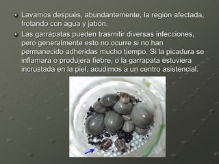 Lavamos después, abundantemente, la región afectada,
frotando con agua y jabón.
Las garrapatas pueden trasmitir diversas infecciones,
pero generalmente esto no ocurre si no han
permanecido adheridas mucho tiempo. Si la picadura se
inflamara o produjera fiebre, o la garrapata estuviera
incrustada en la piel, acudimos a un centro asistencial.
 