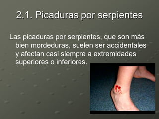2.1. Picaduras por serpientes
Las picaduras por serpientes, que son más
bien mordeduras, suelen ser accidentales
y afectan casi siempre a extremidades
superiores o inferiores.
 