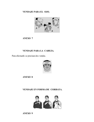 VENDAJE PARA EL OJO.
ANEXO 7
VENDAJE PARA LA CABEZA.
Para efectuarlo se precisan dos vendas.
ANEXO 8
VENDAJE EN FORMA DE CORBATA.
ANEXO 9
 