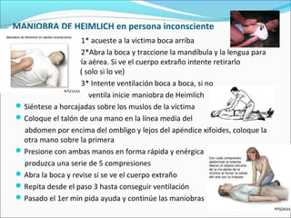MANIOBRA DE HEIMLICH en persona inconsciente
1* acueste a la victima boca arriba
2*Abra la boca y traccione la mandíbula y la lengua para
ver la vía aérea. Si ve el cuerpo extraño intente retirarlo
con los dedos( solo si lo ve)
3* Intente ventilación boca a boca, si no
ventila inicie maniobra de Heimlich
Siéntese a horcajadas sobre los muslos de la víctima
Coloque el talón de una mano en la línea media del
abdomen por encima del ombligo y lejos del apéndice xifoides, coloque la
otra mano sobre la primera
Presione con ambas manos en forma rápida y enérgica
produzca una serie de 5 compresiones
Abra la boca y revise si se ve el cuerpo extraño
Repita desde el paso 3 hasta conseguir ventilación
Pasado el 1er min pida ayuda y continúe las maniobras
 