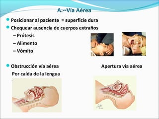 A.--Vía Aérea
Posicionar al paciente = superficie dura
Chequear ausencia de cuerpos extraños
– Prótesis
– Alimento
– Vómito
Obstrucción vía aérea Apertura vía aérea
Por caída de la lengua
 