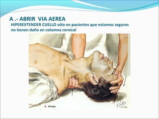 A .- ABRIR VIA AEREA
HIPEREXTENDER CUELLO sólo en pacientes que estamos seguros
no tienen daño en columna cervical
 