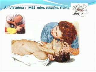 A.- Vía aérea : MES mire, escuche, sienta
 