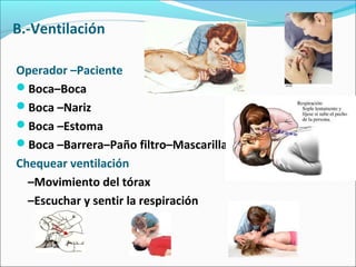 B.-Ventilación
Operador –Paciente
Boca–Boca
Boca –Nariz
Boca –Estoma
Boca –Barrera–Paño filtro–Mascarilla
Chequear ventilación
–Movimiento del tórax
–Escuchar y sentir la respiración
 