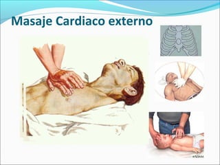 Masaje Cardiaco externo
 