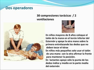 Dos operadores
30 compresiones torácicas / 2
ventilaciones
En niños mayores de 8 años coloque el
talón de la mano en el tercio inferior del
Esternón y apoye la otra mano sobre la
primera entrelazando los dedos que no
deben tocar el tórax
En niños más pequeños solo usar el talón
de una mano con la otra afirmar la frente
para mantener la posición.
En lactantes apoye sólo la punta de los
dedos indice y medio en la parte media
del externón
 