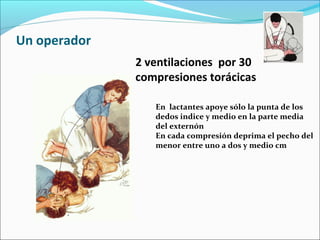 Un operador
2 ventilaciones por 30
compresiones torácicas
En lactantes apoye sólo la punta de los
dedos indice y medio en la parte media
del externón
En cada compresión deprima el pecho del
menor entre uno a dos y medio cm
 