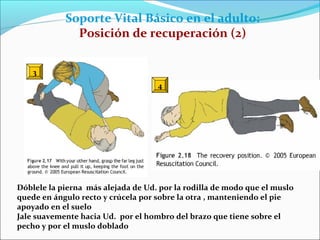 3
Soporte Vital Básico en el adulto:
Posición de recuperación (2)
4
Dóblele la pierna más alejada de Ud. por la rodilla de modo que el muslo
quede en ángulo recto y crúcela por sobre la otra , manteniendo el pie
apoyado en el suelo
Jale suavemente hacia Ud. por el hombro del brazo que tiene sobre el
pecho y por el muslo doblado
 