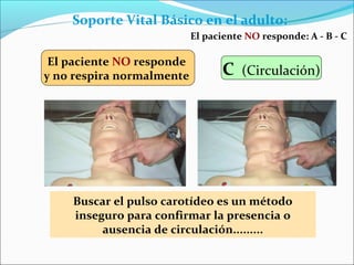 El paciente NO responde
y no respira normalmente
Soporte Vital Básico en el adulto:
C (Circulación)
El paciente NO responde: A - B - C
Buscar el pulso carotídeo es un método
inseguro para confirmar la presencia o
ausencia de circulación.........
 
