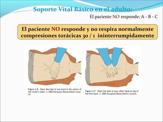 El paciente NO responde y no respira normalmente
compresiones torácicas 30 / 1 ininterrumpidamente
Soporte Vital Básico en el adulto:
El paciente NO responde: A - B - C
 