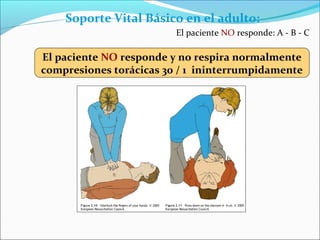 Soporte Vital Básico en el adulto:
El paciente NO responde: A - B - C
El paciente NO responde y no respira normalmente
compresiones torácicas 30 / 1 ininterrumpidamente
 