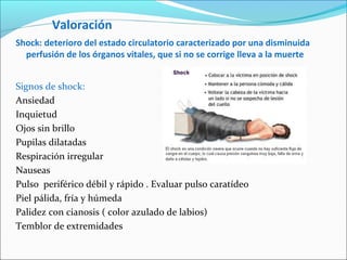 Valoración
Shock: deterioro del estado circulatorio caracterizado por una disminuida
perfusión de los órganos vitales, que si no se corrige lleva a la muerte
Signos de shock:
Ansiedad
Inquietud
Ojos sin brillo
Pupilas dilatadas
Respiración irregular
Nauseas
Pulso periférico débil y rápido . Evaluar pulso caratídeo
Piel pálida, fría y húmeda
Palidez con cianosis ( color azulado de labios)
Temblor de extremidades
 