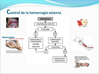 Control de la hemorragia externa
 