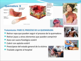 Quemadura B
Tratamiento: PARE EL PROCESO DE LA QUEMADURA
Retirar ropa que pueden seguir el proceso de la quemadura
Retirar joyas u otros elementos que pueden comprimir
Aseo con suero fisiológico estéril
Cubrir con apósito estéril
Preocúpese del estado general de la víctima
Traslado urgente al hospital
 