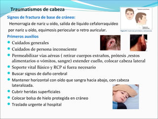 Traumatismos de cabeza
Signos de fractura de base de cráneo:
Hemorragia de nariz u oído, salida de líquido cefalorraquídeo
por nariz u oído, equimosis periocular o retro auricular.
Primeros auxilios
Cuidados generales
Cuidados de persona inconsciente
Permeabilizar vías aéreas ( retirar cuerpos extraños, prótesis ,restos
alimentarios o vómitos, sangre) extender cuello, colocar cabeza lateral
Soporte vital Básico y RCP si fuera necesario
Buscar signos de daño cerebral
Mantener horizontal con oído que sangra hacia abajo, con cabeza
lateralizada.
Cubrir heridas superficiales
Colocar bolsa de hielo protegida en cráneo
Traslado urgente al hospital
 