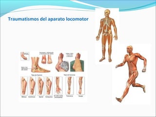 Traumatismos del aparato locomotor
 