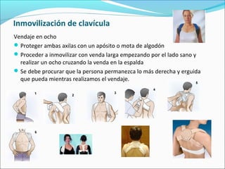 Inmovilización de clavícula
Vendaje en ocho
Proteger ambas axilas con un apósito o mota de algodón
Proceder a inmovilizar con venda larga empezando por el lado sano y
realizar un ocho cruzando la venda en la espalda
Se debe procurar que la persona permanezca lo más derecha y erguida
que pueda mientras realizamos el vendaje.
 