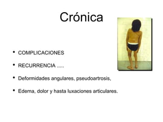 Crónica
• COMPLICACIONES
• RECURRENCIA .....
• Deformidades angulares, pseudoartrosis,
• Edema, dolor y hasta luxaciones articulares.
 