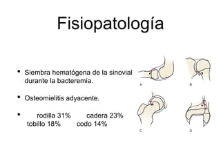 Fisiopatología
• Siembra hematógena de la sinovial
durante la bacteremia.
• Osteomielitis adyacente.
• rodilla 31% cadera 23%
tobillo 18% codo 14%
 
