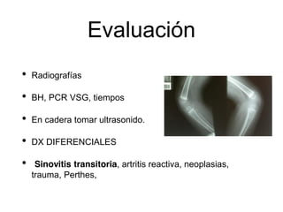 Evaluación
• Radiografías
• BH, PCR VSG, tiempos
• En cadera tomar ultrasonido.
• DX DIFERENCIALES
• Sinovitis transitoria, artritis reactiva, neoplasias,
trauma, Perthes,
 