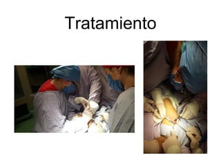 Tratamiento
 