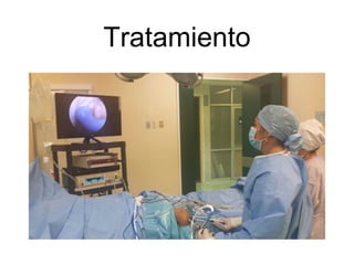 Tratamiento
 