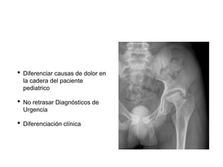 • Diferenciar causas de dolor en
la cadera del paciente
pediatrico
• No retrasar Diagnósticos de
Urgencia
• Diferenciación clínica
 