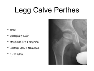 Legg Calve Perthes
• 1910.
• Etiología ? NAV
• Masculino 4>1 Femenino
• Bilateral 20% = 18 meses
• 3 - 10 años
 