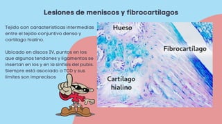 Lesiones de meniscos y fibrocartílagos
Tejido con características intermedias
entre el tejido conjuntivo denso y
cartílago hialino.
Ubicado en discos IV, puntos en los
que algunos tendones y ligamentos se
insertan en los y en la sínfisis del pubis.
Siempre está asociado a TCD y sus
límites son imprecisos
 