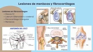 Lesiones de meniscos y fibrocartílagos
Discos IV
Labrum (Glenoideo y cadera)
Fibrocartílago triangular
Meniscos
Lesiones en fibrocartílagos
 