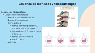 Lesiones de meniscos y fibrocartílagos
Discos intervertebrales
Deshidratación del disco
Protrusión de disco
Hernia discal
Hernia central (posterior).
Produce dolor bilateral.
Hernia lateral. Produce dolor
unilateral.
Hernia posterolateral
Hernia axial
Artrosis
Lesiones en fibrocartílagos
 