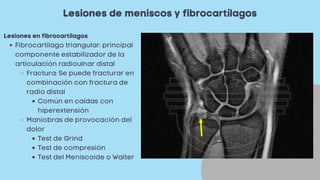 Lesiones de meniscos y fibrocartílagos
Fibrocartílago triangular: principal
componente estabilizador de la
articulación radioulnar distal
Fractura: Se puede fracturar en
combinación con fractura de
radio distal
Común en caídas con
hiperextensión
Maniobras de provocación del
dolor
Test de Grind
Test de compresión
Test del Meniscoide o Waiter
Lesiones en fibrocartílagos
 
