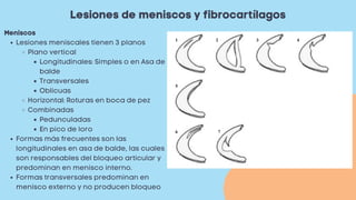 Lesiones de meniscos y fibrocartílagos
Lesiones meniscales tienen 3 planos
Plano vertical
Longitudinales: Simples o en Asa de
balde
Transversales
Oblicuas
Horizontal: Roturas en boca de pez
Combinadas
Pedunculadas
En pico de loro
Formas más frecuentes son las
longitudinales en asa de balde, las cuales
son responsables del bloqueo articular y
predominan en menisco interno.
Formas transversales predominan en
menisco externo y no producen bloqueo
Meniscos
 