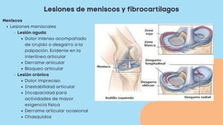 Lesiones de meniscos y fibrocartílagos
Lesiones meniscales
Lesión aguda
Dolor intenso acompañado
de crujido o desgarro a la
palpación. Evidente en la
interlínea articular
Derrame articular
Bloqueo articular
Lesión crónica
Dolor impreciso
Inestabilidad articular
Incapacidad para
actividades de mayor
exigencia física
Derrame articular ocasional
Chasquidos
Meniscos
 