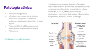 Patología clínica
● Predisposición genética.
● Infecciones que causan una activación
inmunitaria y respuesta cruzada con
antígenos endógenos en la sinovial y en otros
tejidos.
● Variantes HLA DR4 y DR1, y otros genes
implicados en la respuesta inmunitaria.
● Tabaquismo.
→ Embarazo es un efecto protector.
Histológicamente se puede observar inflamación
sinovial con infiltrado de linfocitos, polimorfonucleares
y macrofagos con hipertrofia sinovial → Estas celulas
liveran TNF, IL-1, IL-6, RANKL (activadores de
osteoclastos e incremento de proteasa) → Degradacion
de ligamentos, tendones, huesos y cartilagos.
 