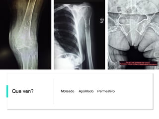 Que ven? Moteado Apolillado Permeativo
 