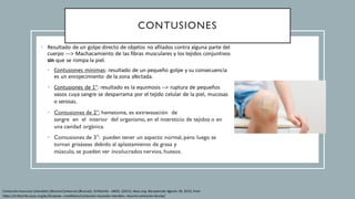 CONTUSIONES
• Resultado de un golpe directo de objetos no afilados contra alguna parte del
cuerpo ---> Machacamiento de las fibras musculares y los tejidos conjuntivos
sin que se rompa la piel.
• Contusiones mínimas: resultado de un pequeño golpe y su consecuencia
es un enrojecimiento de la zona afectada.
• Contusiones de 1°: resultado es la equimosis --> ruptura de pequeños
vasos cuya sangre se desparrama por el tejido celular de la piel, mucosas
o serosas.
• Contusiones de 2°: hematoma, es extravasación de
sangre en el interior del organismo, en el intersticio de tejidos o en
una cavidad orgánica.
• Contusiones de 3°: pueden tener un aspecto normal, pero luego se
tornan grisáseas debido al aplastamiento de grasa y
músculo, se pueden ver incolucrados nervios, huesos.
Contusión muscular (moretón) (MuscleContusion (Bruise)) - OrthoInfo - AAOS. (2021). Aaos.org. Recuperado Agosto 28, 2023, from
https://orthoinfo.aaos.org/es/diseases--conditions/contusion-muscular-moreton--muscle-contusion-bruise/
 