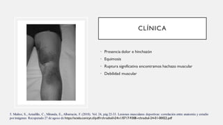 CLÍNICA
• Presencia dolor e hinchazón
• Equimosis
• Ruptura significativa encontramos hachazo muscular
• Debilidad muscular
5. Muñoz, S., Astudillo, C., Miranda, E., Albarracin, F. (2018). Vol. 24, pág 22-33. Lesiones musculares deportivas: correlación entre anatomía y estudio
porimágenes Recuperado 27 de agoso de https://scielo.conicyt.cl/pdf/rchradiol/v24n1/0717-9308-rchradiol-24-01-00022.pdf
 
