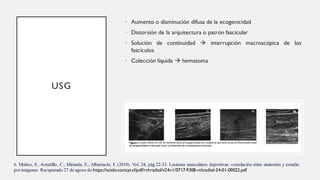 USG
• Aumento o disminución difusa de la ecogenicidad
• Distorsión de la arquitectura o patrón fascicular
• Solución de continuidad → interrupción macroscópica de los
fascículos
• Colección líquida → hematoma
6. Muñoz, S., Astudillo, C., Miranda, E., Albarracin, F. (2018). Vol. 24, pág 22-33. Lesiones musculares deportivas: correlación entre anatomía y estudio
porimágenes Recuperado 27 de agoso de https://scielo.conicyt.cl/pdf/rchradiol/v24n1/0717-9308-rchradiol-24-01-00022.pdf
 