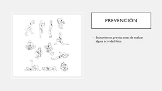 PREVENCIÓN
• Estiramientos previos antes de realizar
alguna actividad física
 