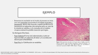 EJEMPLO
• Entonces en una lesión en el muslo,el proceso se inicia
con una contusión,que produce una lesión muscular y
hematoma dentro del músculo y tejidos periféricos.El
hematoma se reabsorbe a las semanas,pero en caso de
la miositis se calcifica,y a la consulta con el médico
cirujano evaluará la posible resección quirúrgica.
Se distinguen Dos fases.
• Fase Caliente:El área está edematizada y suele ser
hipersensible a la palpación,El dolor y la tumefacción
disminuyen la flexibilidad.
• Fase Fría: La Calcificación se estabiliza.
MIOSITIS OSIFICANTE. QUÉ ES Y CUÁLES SON SUS SÍNTOMAS Y SU TRATAMIENTO. (2015).Lamas, J. FisioOnline.Recuperado Agosto 2023. https://www.fisioterapia-online.com/articulos/miositis-osificante-que-es-y-
cuales-son-sus-sintomas-y-su-tratamiento
 